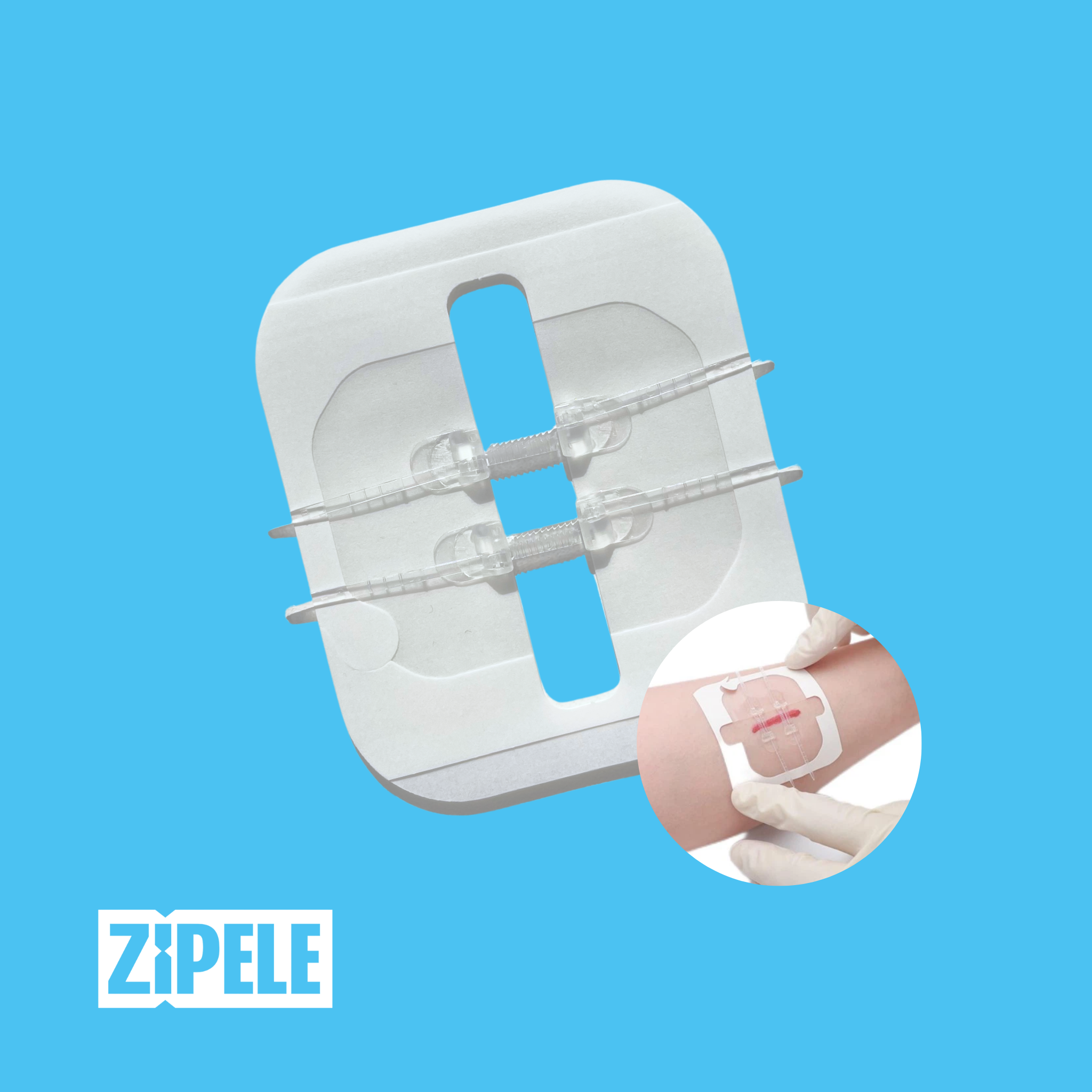 ZiPele - Curativo inteligente para fechamento de feridas