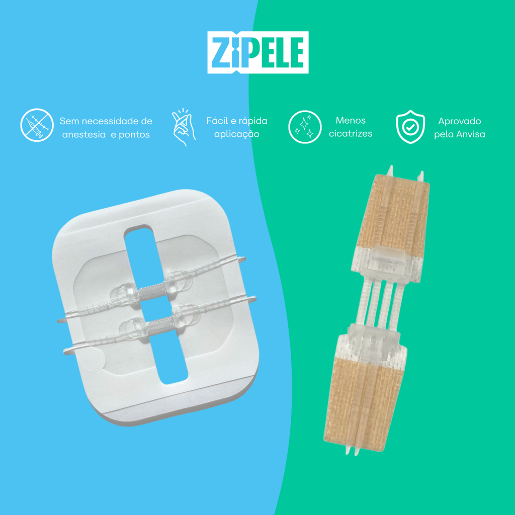 ZiPele - Curativo inteligente para fechamento de feridas