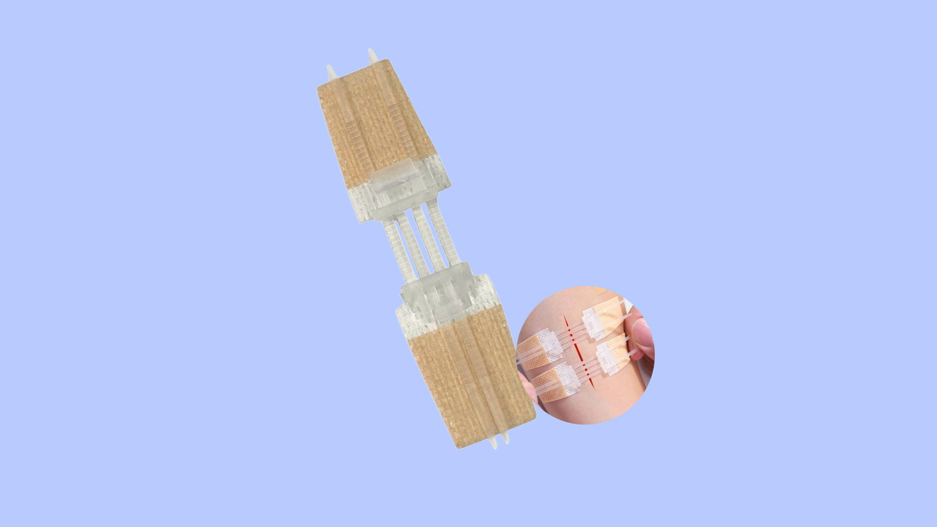 ZiPele - Curativo inteligente para fechamento de feridas