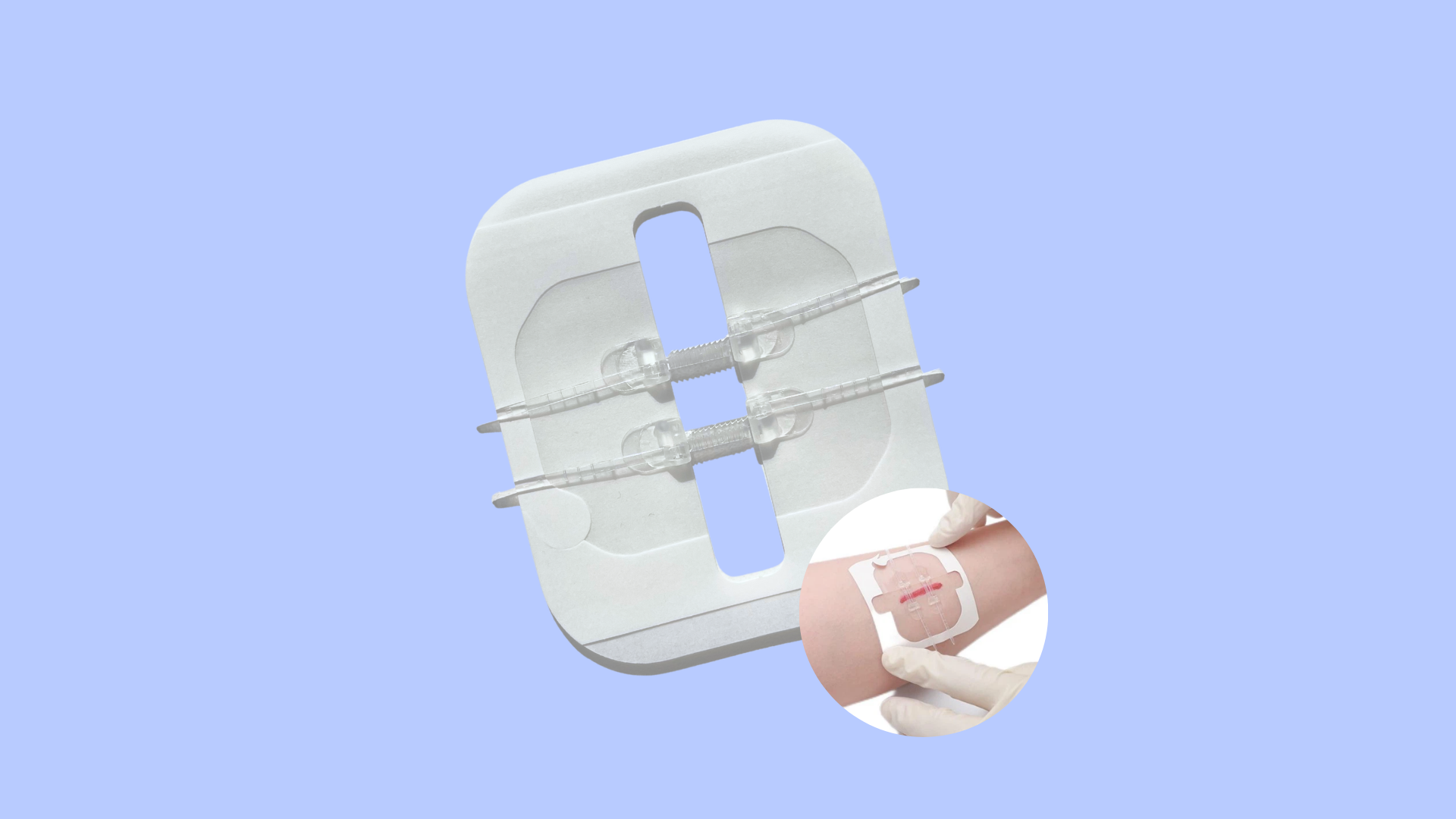 ZiPele - Curativo inteligente para fechamento de feridas